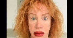 trump-hater-kathy-griffin-unable-to-speak-after-latest-surgery