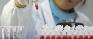 fact-check:-were-over-40,000-people-in-houston,-texas-diagnosed-with-an-std-the-week-of-june-9?