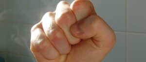 video-shows-62-year-old-man-land-vicious-right-hand-at-arkansas-gop-meeting