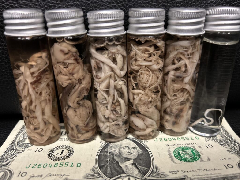 podcast-interview:-embalmer-reveals-50%-of-bodies-containing-“white,-fibrous”-clots-since-april/may-2021-|-the-gateway-pundit-|-by-brian-lupo