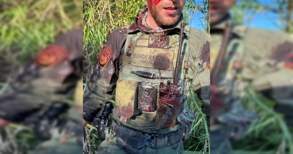 former-texas-congresswoman-mayra-flores-shares-bloody-photo-of-border-patrol-agent-after-alleged-attack-by-illegal-|-the-gateway-pundit-|-by-margaret-flavin