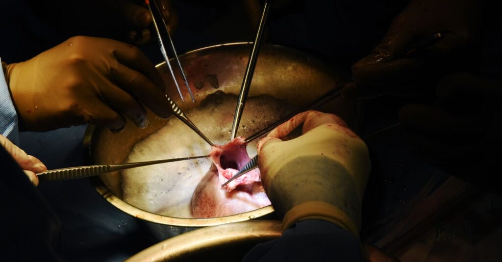 how-to-make-a-pig-heart-transplant-last-in-a-person