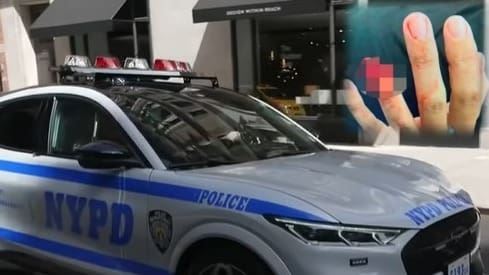 illegal-alien-bites-off-nypd-sergeant’s-finger-|-the-gateway-pundit-|-by-anthony-scott
