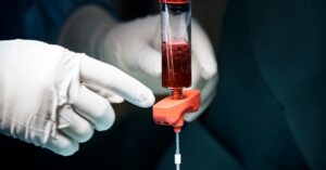 these-stem-cell-treatments-cost-the-rich-thousands.-donors-get-paid-$200