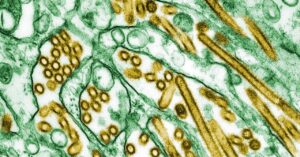 cdc-confirms-first-us-case-of-severe-bird-flu