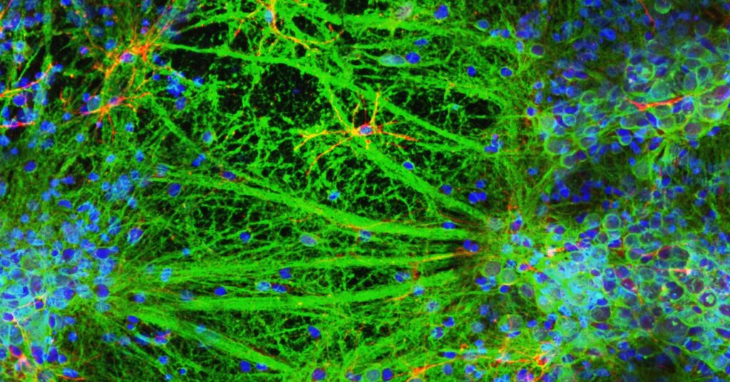 a-lab-just-3d-printed-a-neural-network-of-living-brain-cells