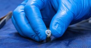 this-blood-vessel-was-grown-in-a-lab-with-real-human-cells