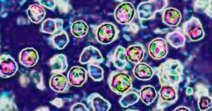 this-is-how-measles-kills