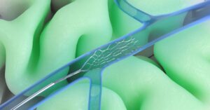 synchron’s-brain-computer-interface-now-has-nvidia’s-ai