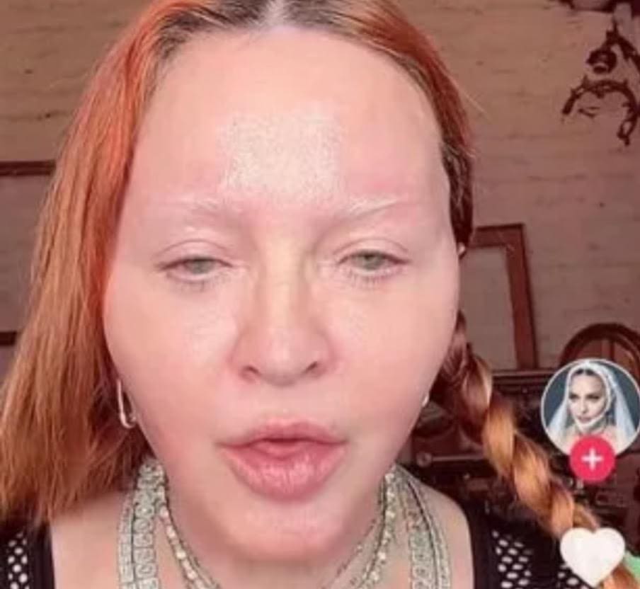 madonna-scares-fans,-looks-unrecognizable-in-new-social-media-post-|-the-gateway-pundit-|-by-cristina-laila