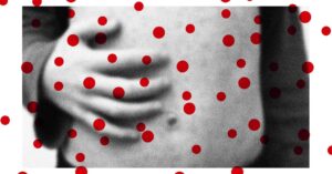 measles-cases-are-rising.-other-preventable-diseases-could-follow