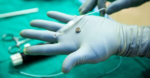 a-neuralink-rival-just-tested-a-brain-implant-in-a-person