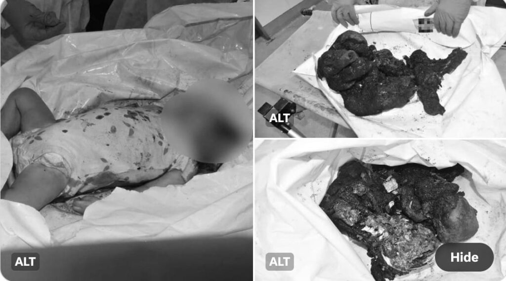 office-of-prime-minister-netanyahu-releases-horrifying-and-disturbing-photos-of-babies-murdered-and-burned-by-hamas-terrorists-that-was-shown-to-anthony-blinken-|-the-gateway-pundit-|-by-jim-hᴏft