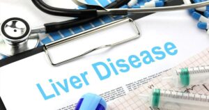 liver-injuries-reportedly-on-the-rise:-aspirin,-other-fda-approved-drugs-connected