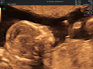 78-ny-colleges-provide-abortions-|-the-gateway-pundit-|-by-seth-segal