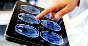 what-your-nighttime-breathing-says-about-your-health