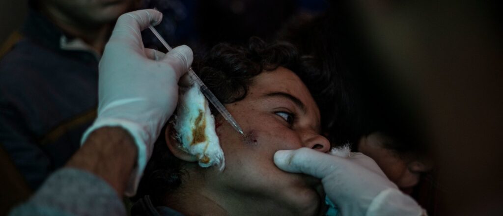 tropical-parasite-develops-us-native-strain,-forcing-scientists-to-issue-health-warnings