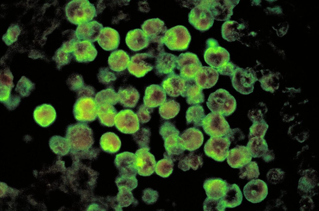 cdc-rules-out-deadly-‘brain-eating’-amoeba-in-mysterious-arizona-infection