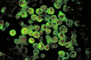 cdc-rules-out-deadly-‘brain-eating’-amoeba-in-mysterious-arizona-infection