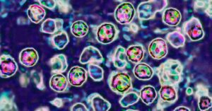 the-us-is-in-for-another-bad-year-of-measles-cases