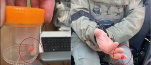 anti-ice-rioter-bites-federal-officer