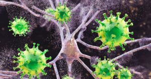 measles-is-causing-brain-swelling-in-children-in-south-carolina