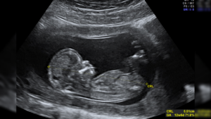 abortion-providers-don’t-deserve-our-appreciation-|-the-gateway-pundit-|-by-guest-contributor