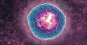 the-shingles-virus-may-be-aging-you-more-quickly