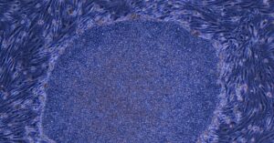 japan-approves-the-world’s-first-treatment-made-with-reprogrammed-human-cells