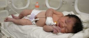 infant-mortality-rises-for-first-time-in-20-years