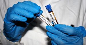 all-your-hantavirus-questions,-answered-by-an-infectious-disease-expert