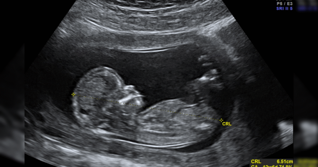 the-four-words-that-define-the-abortion-debate-*-the-gateway-pundit-*-by-guest-contributor