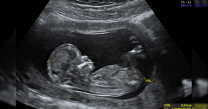 the-four-words-that-define-the-abortion-debate-*-the-gateway-pundit-*-by-guest-contributor