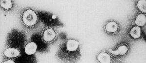 umbc-scientists-discover-‘vampire-virus’-for-the-first-time-in-us