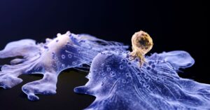 a-cutting-edge-cancer-treatment-may-cause-cancer.-the-fda-is-investigating