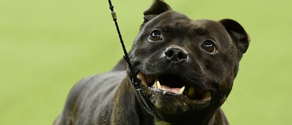 woman-loses-both-legs-after-brutally-attacked-by-3-pitbulls