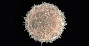 in-a-world-first,-a-patient’s-antibody-cells-were-just-genetically-engineered
