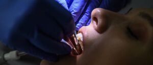 disfigured-woman-sues-dentist-who-allegedly-rushed-20-fillings