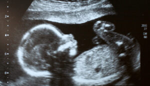 ohio-woman-facing-no-charges-after-allegedly-flushing-corpse-of-stillborn-fetus