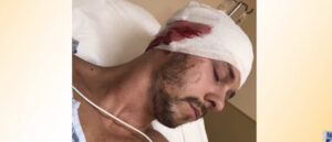 ‘my-head-would’ve-exploded’:-man-says-gopro-camera-saved-his-life-from-alligator-attack:-report