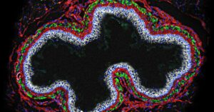 unpicking-the-mystery-of-the-body’s-‘second-brain’
