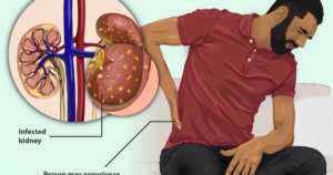 racial-preferences-in-treating-kidney-disease