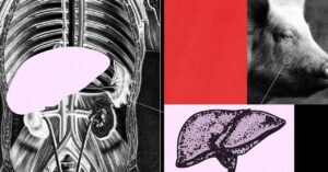 a-gene-edited-pig-liver-was-attached-to-a-person—and-worked-for-3-days