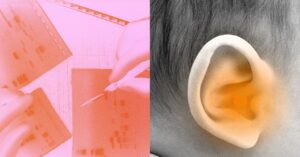 watch-a-deaf-child-regain-hearing-after-a-breakthrough-gene-therapy