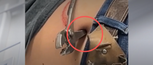 graphic-photos-show-pliers-inside-teen-after-he-accidentally-impaled-himself:-report