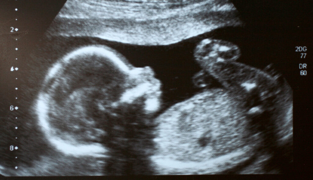 biden’s-state-of-the-union-address-to-push-abortion-–-washington-examiner