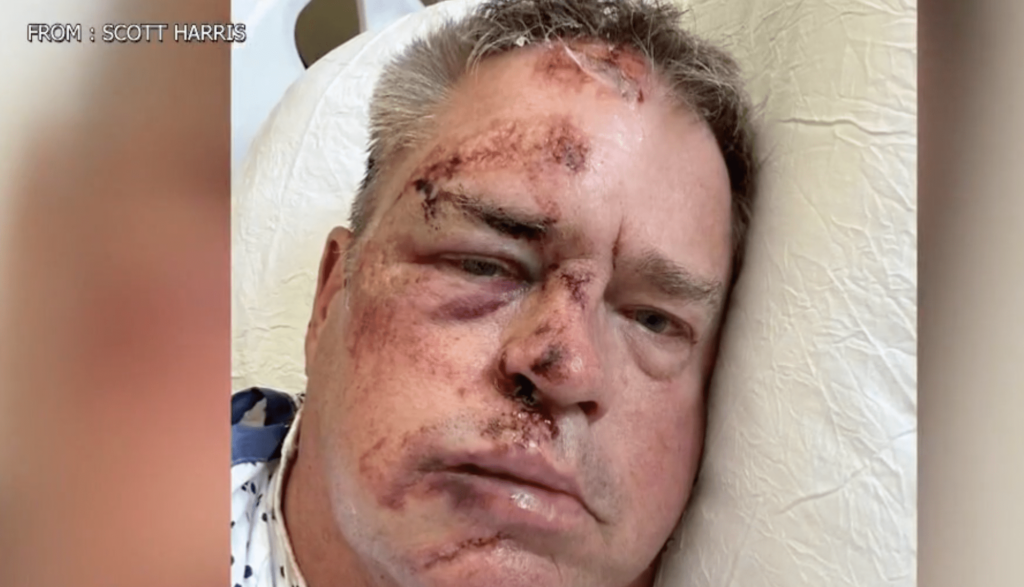 navy-veteran-brutally-beaten-while-walking-dog-in-philly-|-the-gateway-pundit-|-by-margaret-flavin