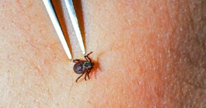a-pill-that-kills-ticks-is-a-promising-new-weapon-against-lyme-disease