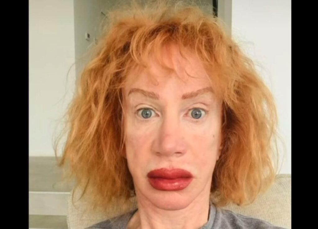 kathy-griffin-brutalized-after-posting-horrifying-photo-of-her-new-tattooed-lips-|-the-gateway-pundit-|-by-cristina-laila