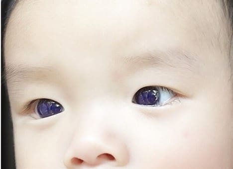 unreal:-baby’s-brown-eyes-turn-bright-blue-after-being-given-a-potentially-dangerous-covid-treatment-|-the-gateway-pundit-|-by-cullen-linebarger